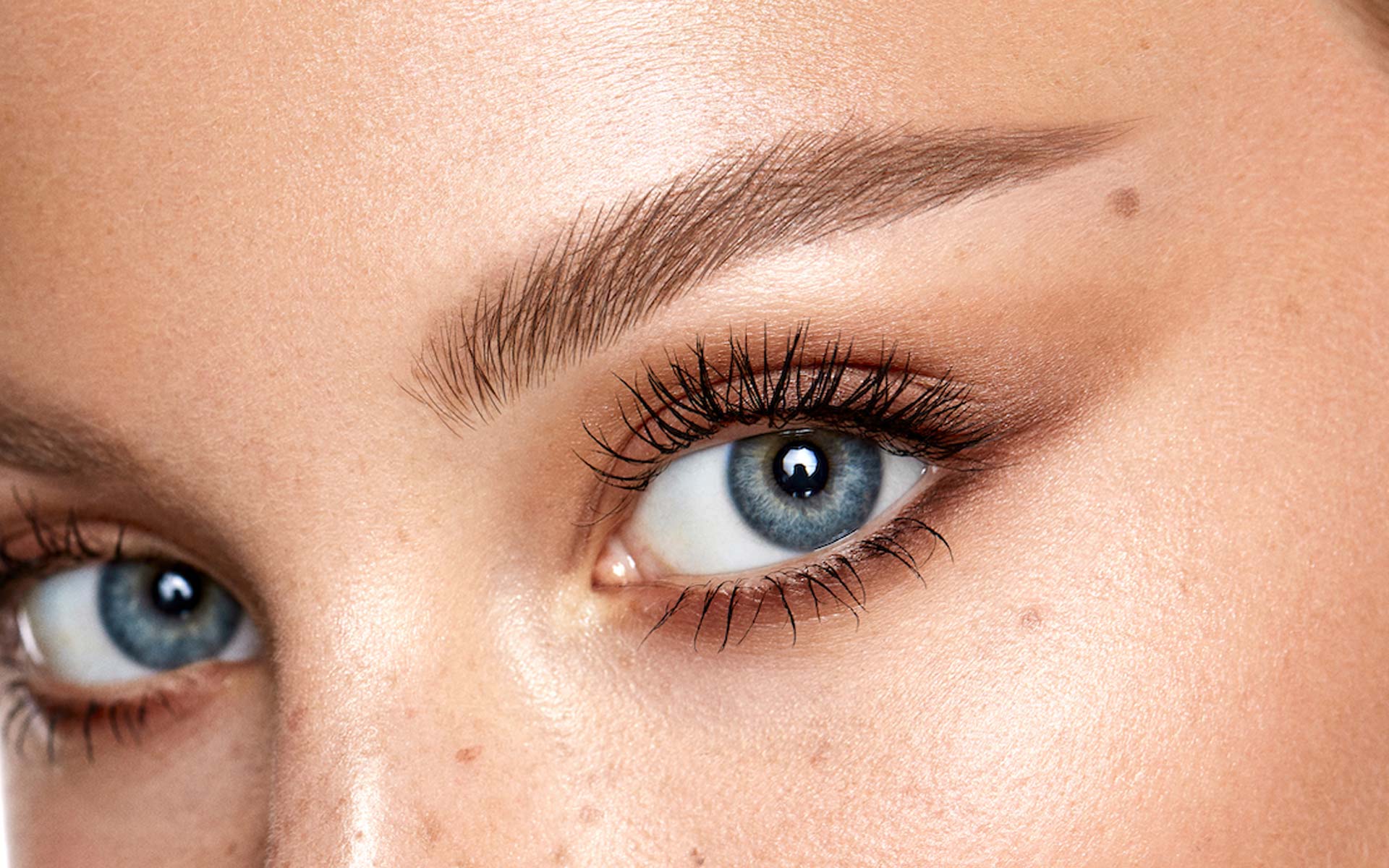 brow-lift-bristol